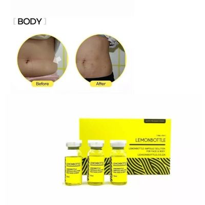 판매 레몬 병 지방 해소기 5X10ml 상자 체중 감량 솔루션 온라인