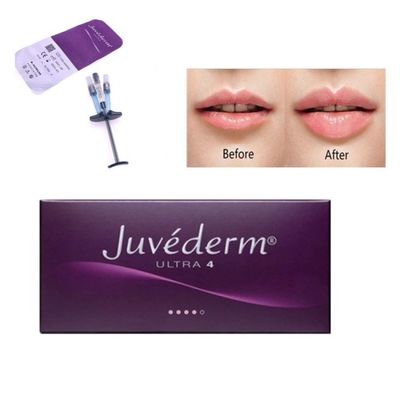 2ml 얼굴 관리 Juvederm Cross Linked 피부 필러 히알루론산 주입
