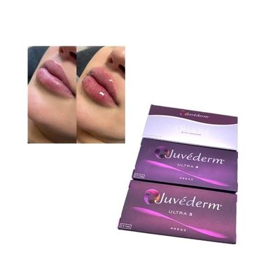 주입 Juvederm Voluma Cross Linked Dermal Filler 주입용 주브더름 볼룸 크로스 링크드 피부 필러