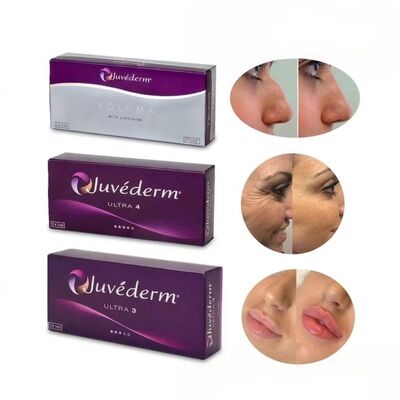 24mg/ml Juvederm 립 필러 Juvederm Ultra3 Ultra4 Voluma 주사용