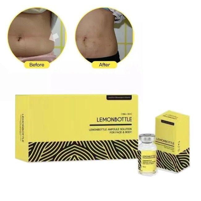 고농도 레몬 병 용액 지방 용해 주입 용액 5 병 X 10ml 전체 몸