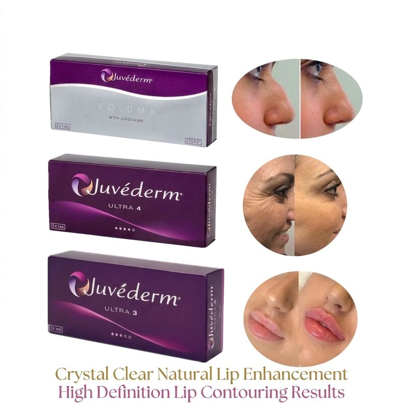 주사기의 부피 2 상자 당 1ml Juvederm Volume Filler 안전 얼굴 외형 부피 증가를 위한 주사용 피부 필러